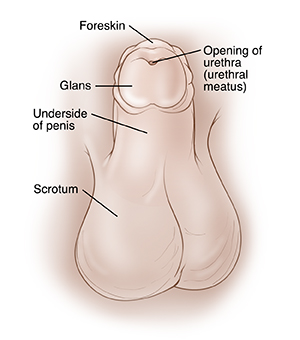 Child's penis with penis pointing up to show underside. Foreskin surrounds glans at top of penis. Scrotum is underneath penis. Opening of urethra is in center of glans.