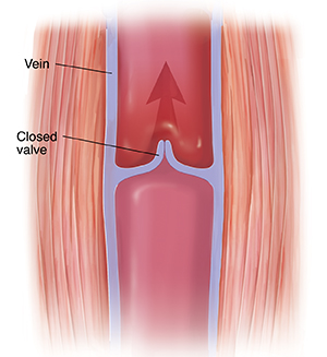 Cross section of muscle and vein showing closed valve. Arrow shows blood moving up.