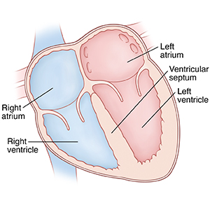 Front view cross section of heart showing atria on top and ventricles on bottom. Ventricular septum is between right ventricle and left ventricle.
