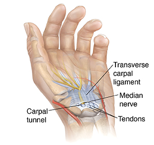Palm view of hand showing carpal tunnel in wrist.