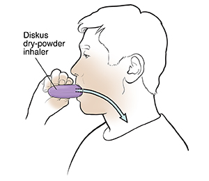 Man using a dry-power inhaler.