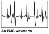 Una forma de onda de EMG.