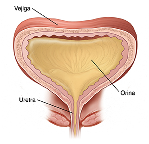 Corte transversal de la vejiga y la uretra. La vejiga está llena de orina. Las paredes de la vejiga se contraen y empujan la orina hacia la uretra para expulsarla del cuerpo.