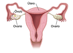 Contorno de una pelvis femenina donde se ven el útero y los ovarios.